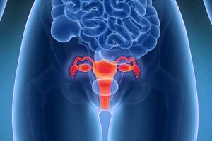Morcellator Cancer Lawsuits Await Courts Decision To Consolidated Uterine Cancer Claims