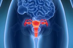 Power Morcellator Lawsuits Allege Undetected Uterine Cancer Spread During Hysterectomy www.southernmedlaw.com 