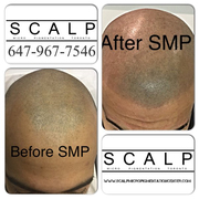Scalp Micropigmentation Center Reviews of SMP by Tino Barbone.  www.scalpmicropigmentationcenter.com