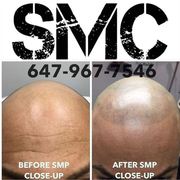 Scalp Micropigmentation Training. Join the soon to be largest network of SMP Professionals in the World.  Franchises and Business Opportunities available to right candidate.