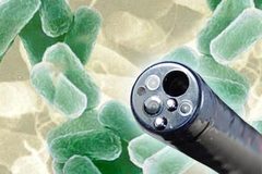 Duodenoscope Infection Lawsuit Reveals Olympus Told U.S. Execute Not To Issue SuperBug Warning