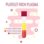Platelet Rich Plasma (PRP) is pulled from blood through a centrifuge machine.