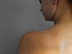 At River City Wellness, acupuncture is used to help boost the body's natural vitality. 