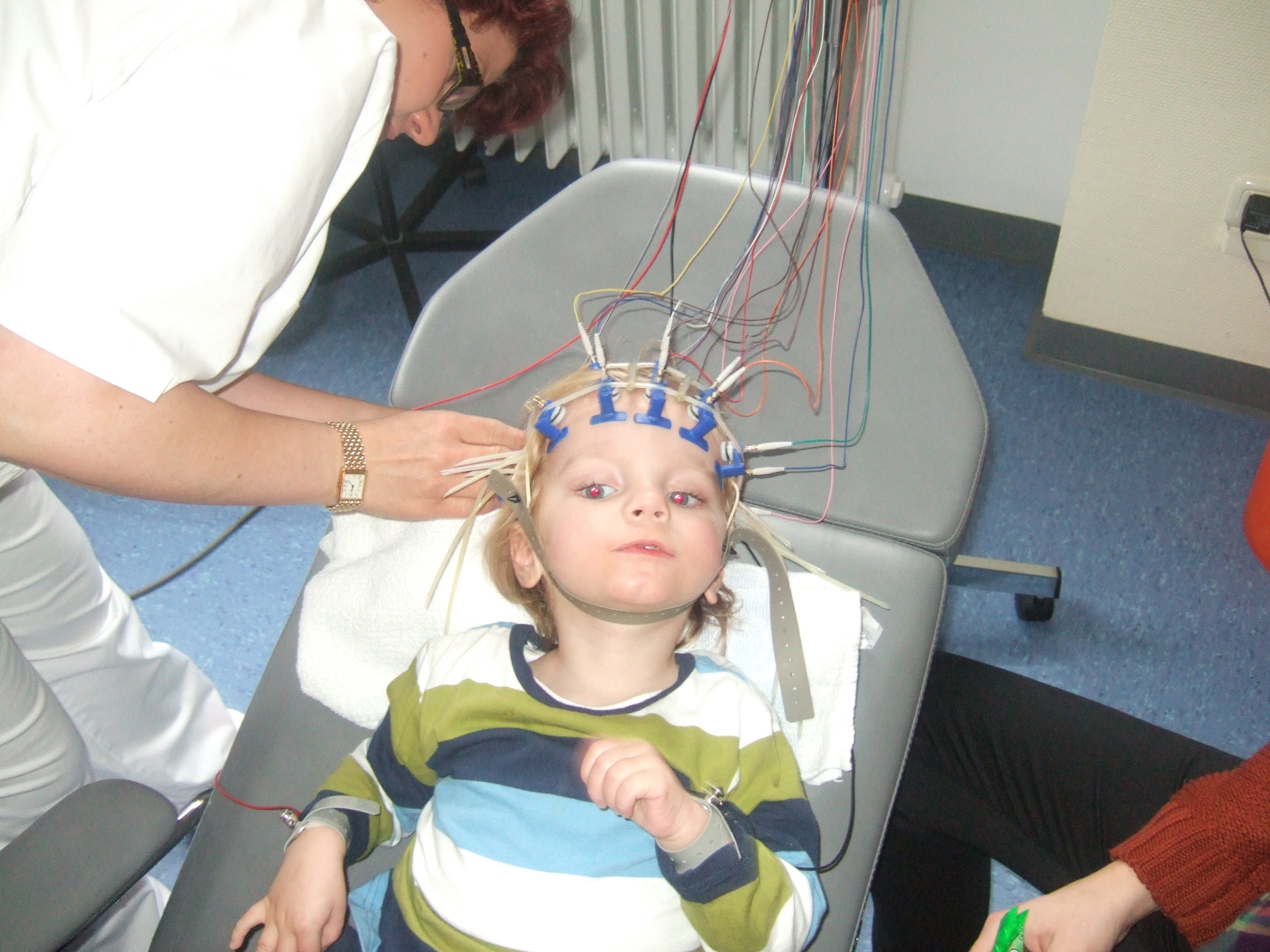 Ээг 3 лет. Транскраниальная электроэнцефалограмма. ЭЭГ детям. Электроэнцефалография у детей. Дети с ДЦП.