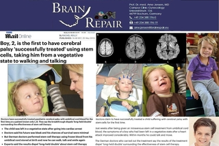 Breakthrough - EUR 50 million investment for start-up BrainRepair UG / Pivotal trial on stem cell treatment for brain da…